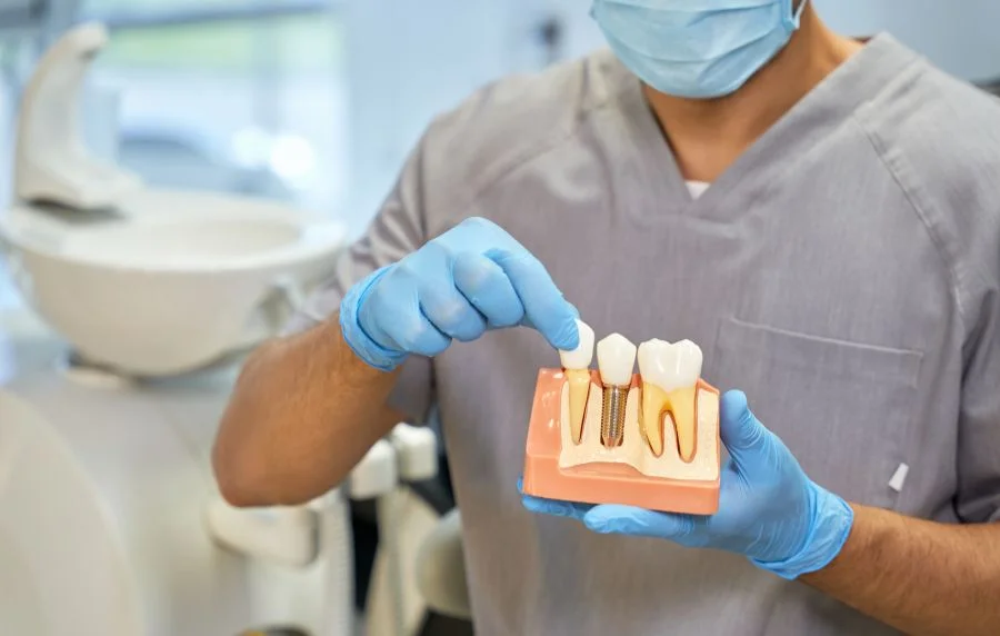 Mejores Implantes Dentales en Helident