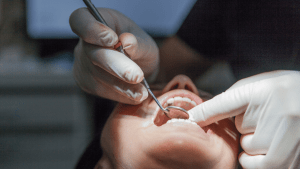 Cirugia de mplantes Dentales