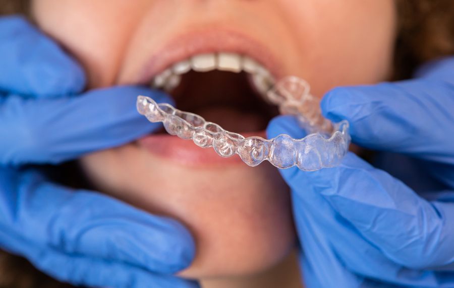 mejor tratamiento de ortodoncia invisible en la Clínica Dental Helident