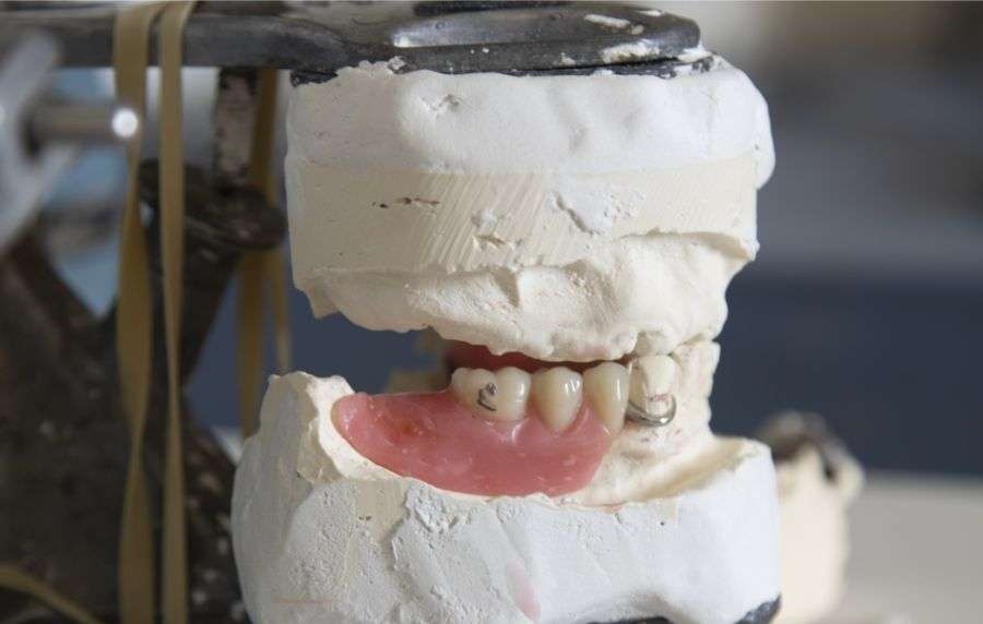 reconstrucción estética dental