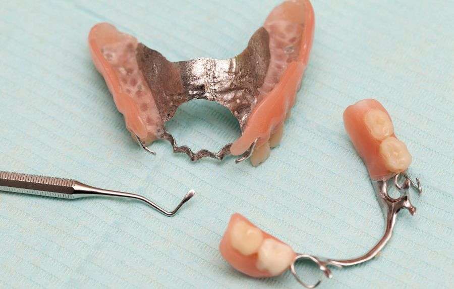 dental protesis