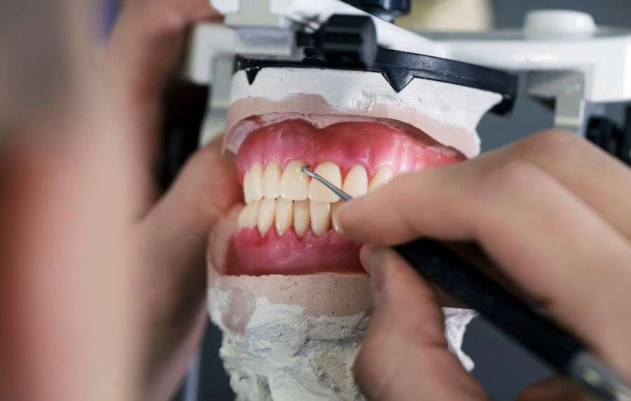 Descubre las Opciones de Restauración Dental en Helident