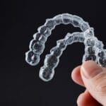 Cuanto tiempo hay que llevar los retenedores Invisalign