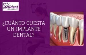 cuánto cuesta un implante dental